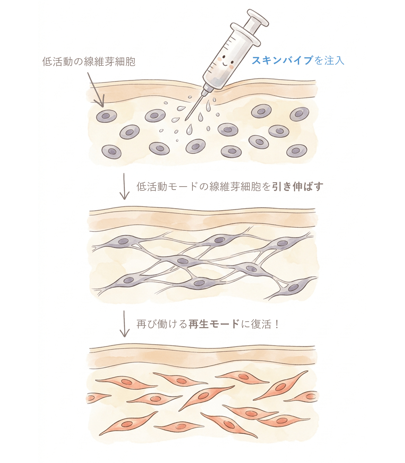 線維芽細胞再生イラスト